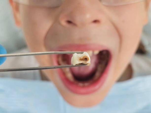 Best Emergency Dental Services for Seniors in Ellerslie, GA